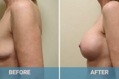 before-and-after-augmentation-2